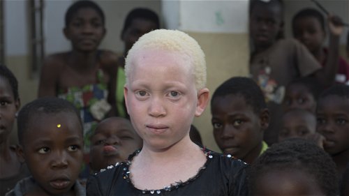 Waren Onze Lieve Vrouw en Jezus mensen met albinisme?