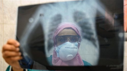 Meer dan 7.000 gezondheidswerkers overleden aan corona